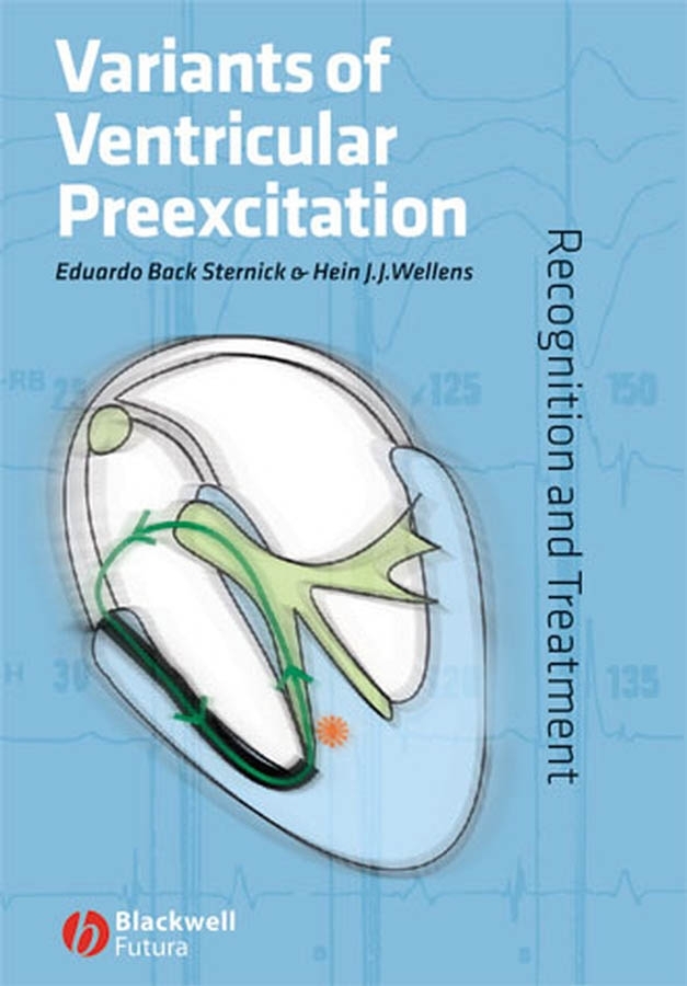 Обложка книги «Variants of Ventricular Preexcitation»