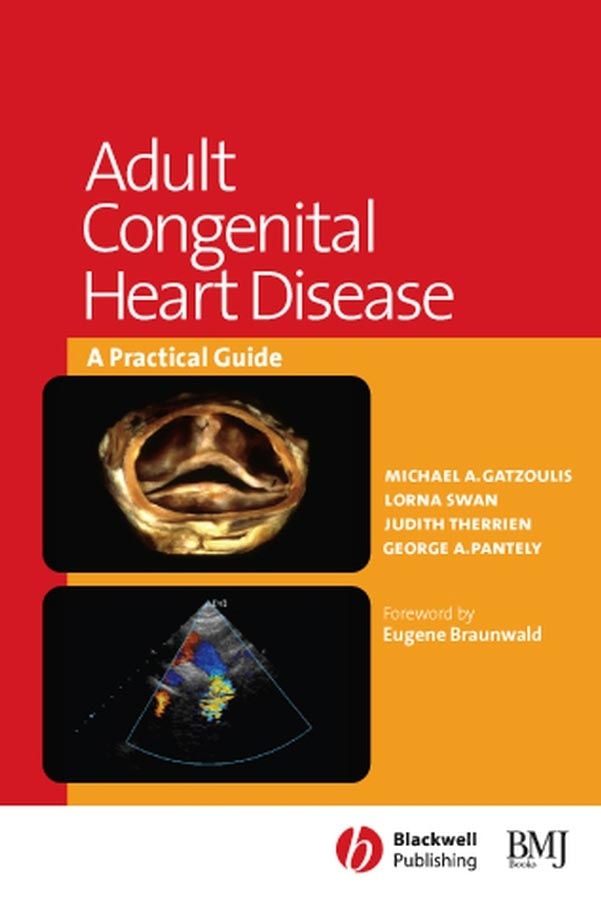 Обложка книги «Adult Congenital Heart Disease»