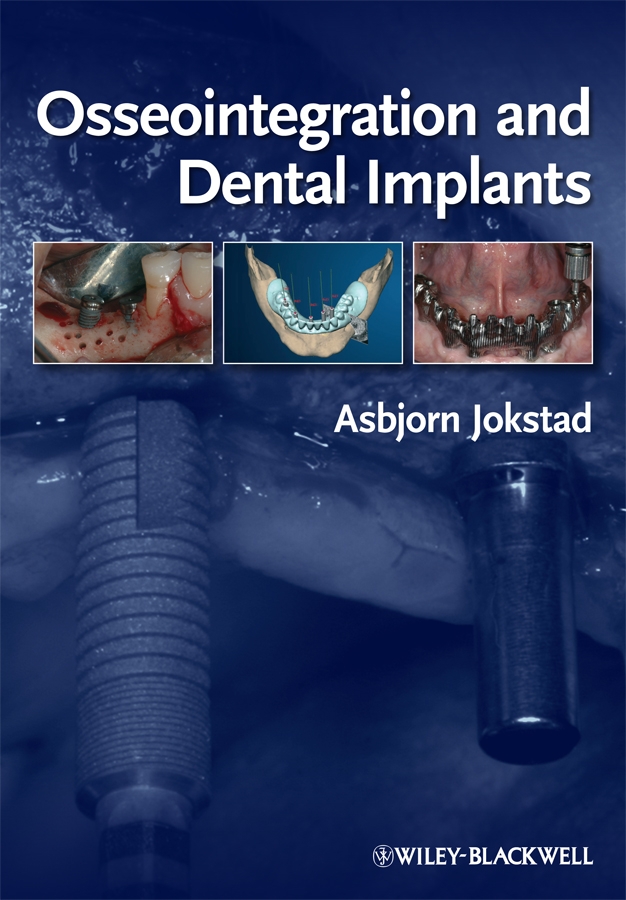 Обложка книги «Osseointegration and Dental Implants»