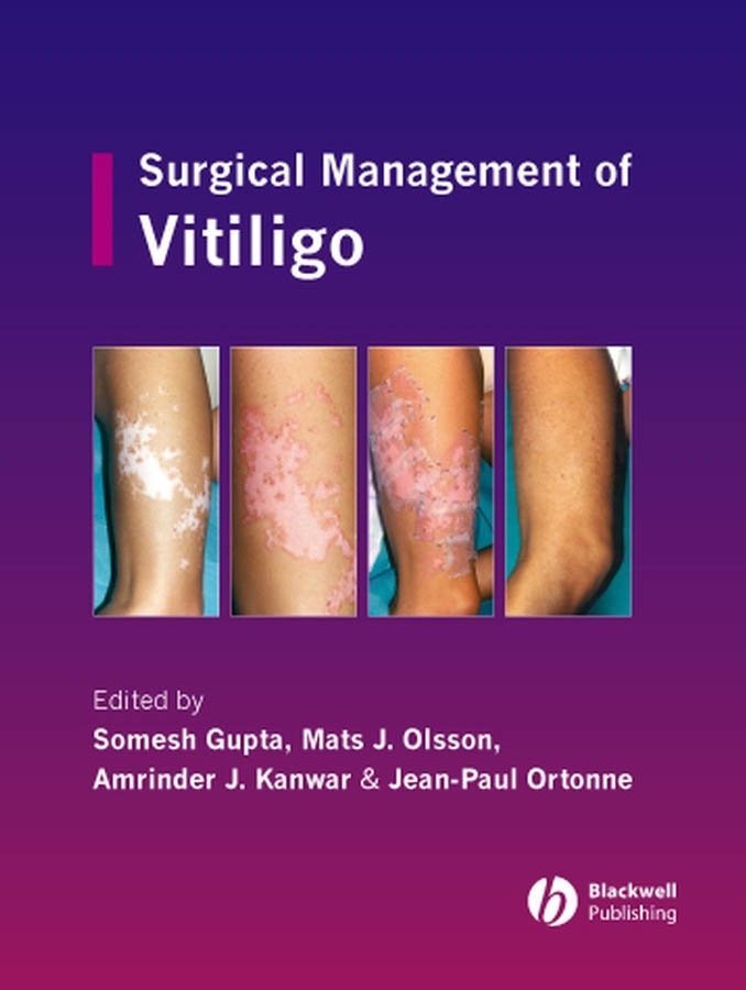 Обложка книги «Surgical Management of Vitiligo»