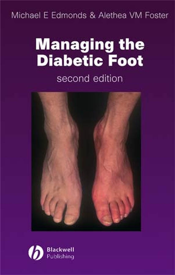 Обложка книги «Managing the Diabetic Foot»