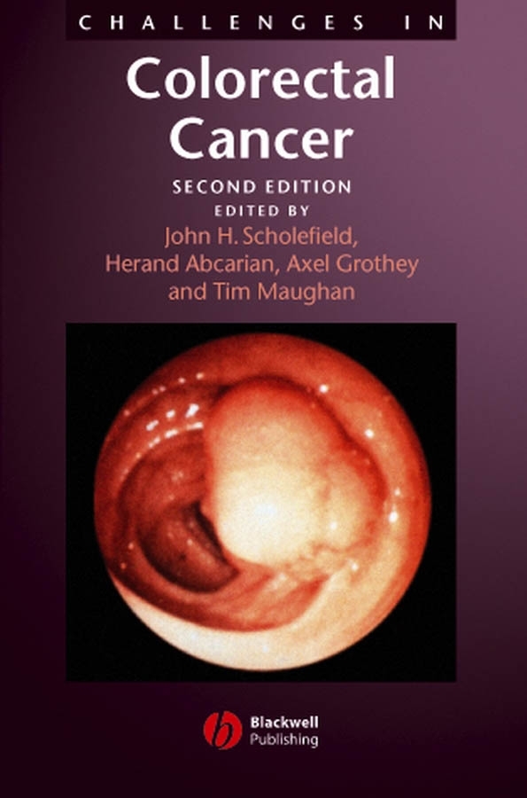 Обложка книги «Challenges in Colorectal Cancer»