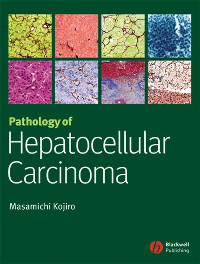 Обложка книги «Pathology of Hepatocellular Carcinoma»