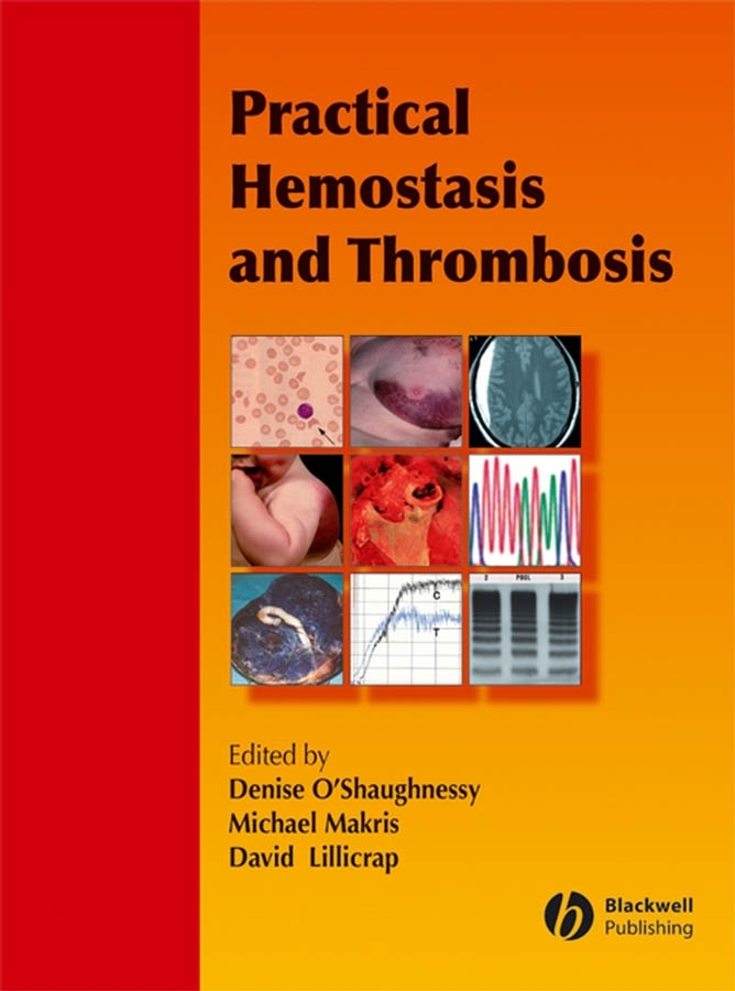 Обложка книги «Practical Hemostasis and Thrombosis»