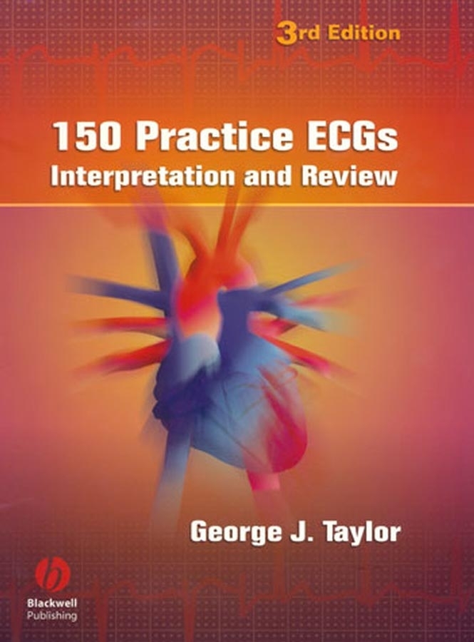 Обложка книги «150 Practice ECGs»