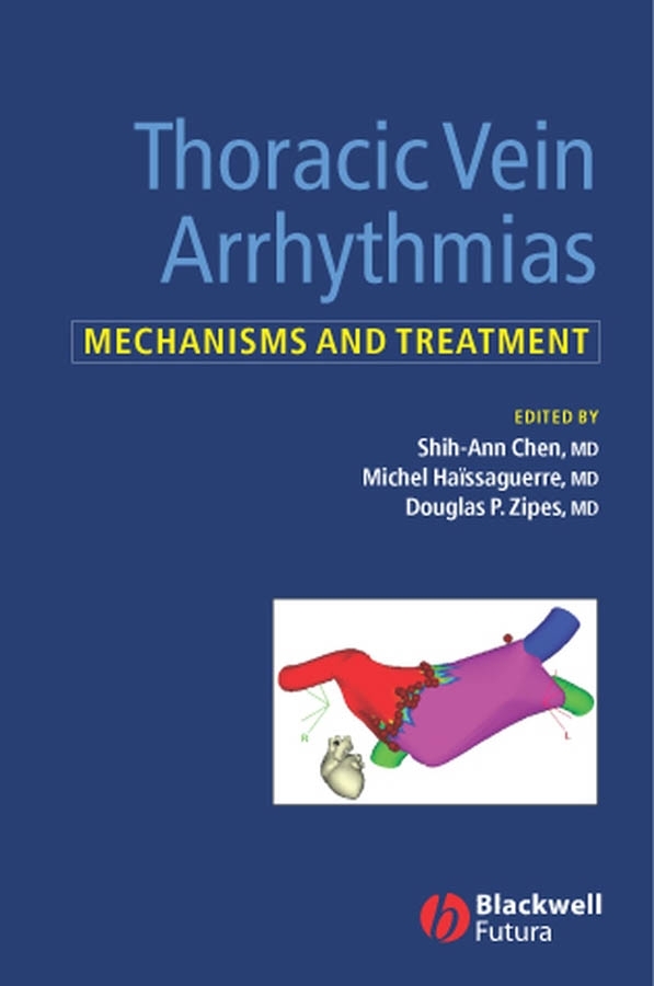 Обложка книги «Thoracic Vein Arrhythmias»