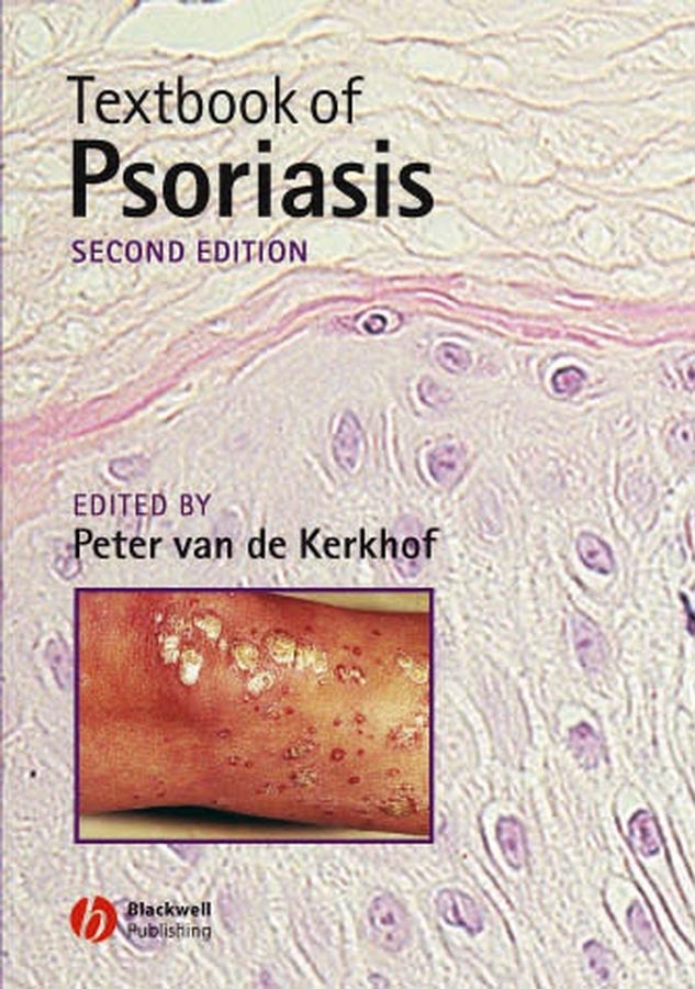Обложка книги «Textbook of Psoriasis»