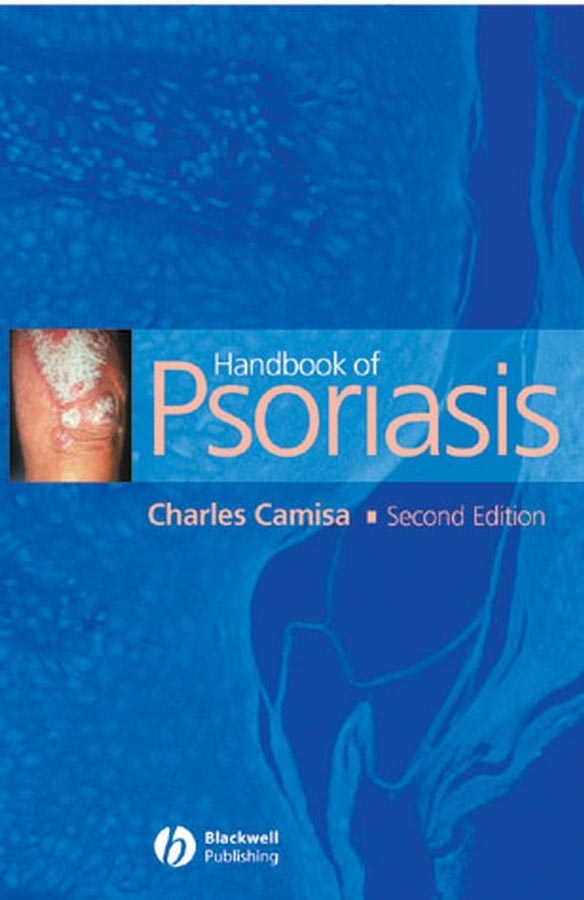 Обложка книги «Handbook of Psoriasis»