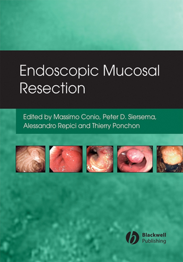 Обложка книги «Endoscopic Mucosal Resection»