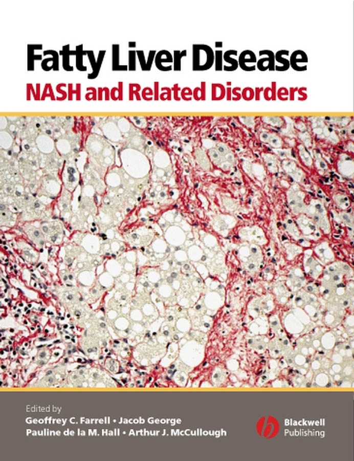 Обложка книги «Fatty Liver Disease»