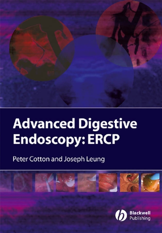 Обложка книги «Advanced Digestive Endoscopy»