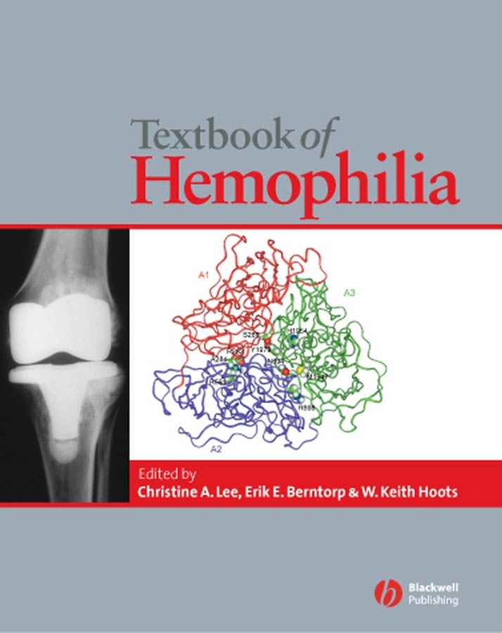 Обложка книги «Textbook of Hemophilia»