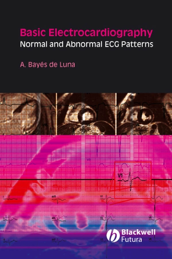Обложка книги «Basic Electrocardiography»