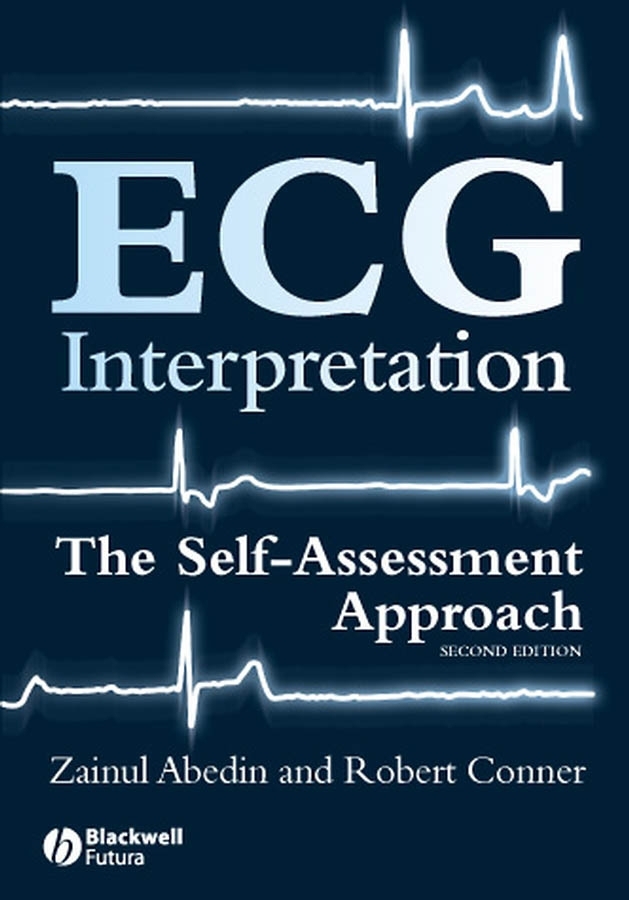 Обложка книги «ECG Interpretation»