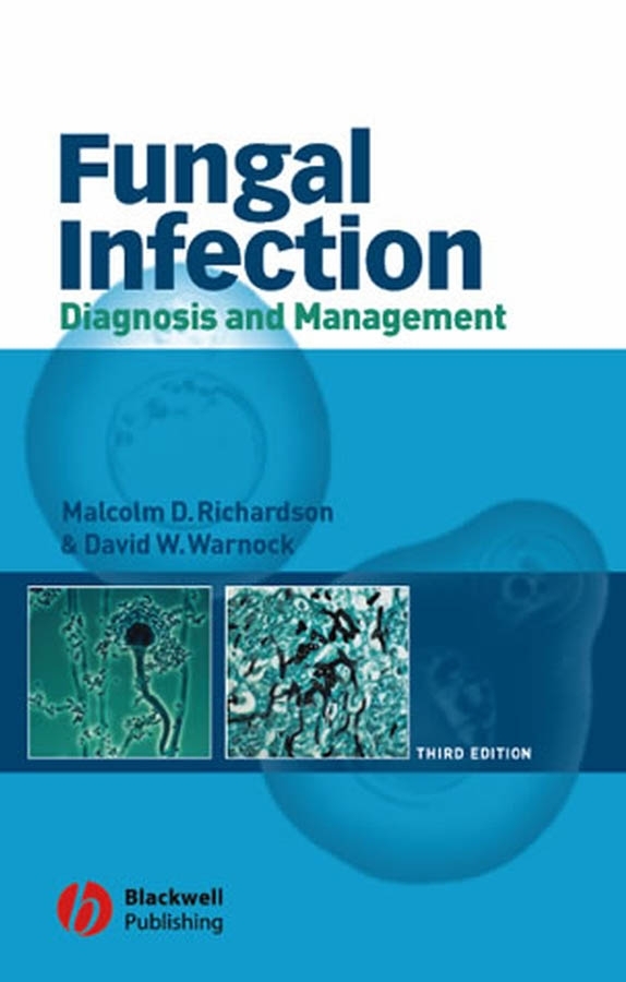 Обложка книги «Fungal Infection»