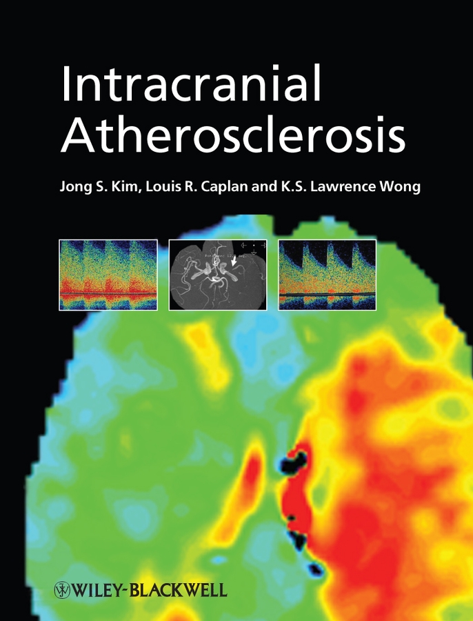 Обложка книги «Intracranial Atherosclerosis»