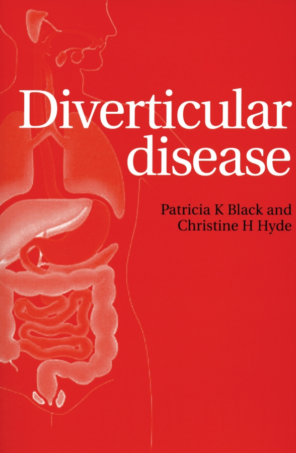 Обложка книги «Diverticular Disease»