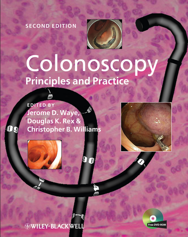 Обложка книги «Colonoscopy»
