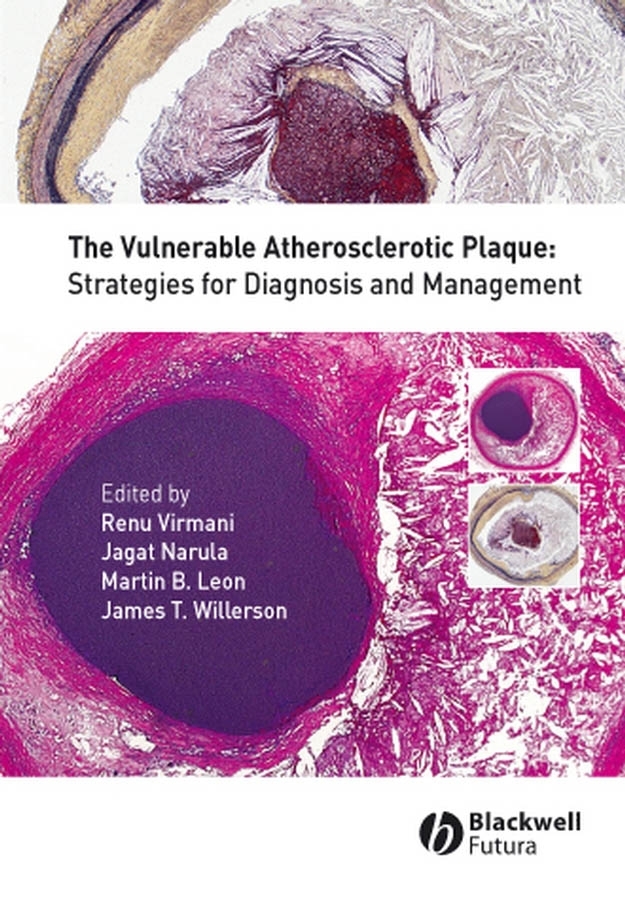 Обложка книги «The Vulnerable Atherosclerotic Plaque»