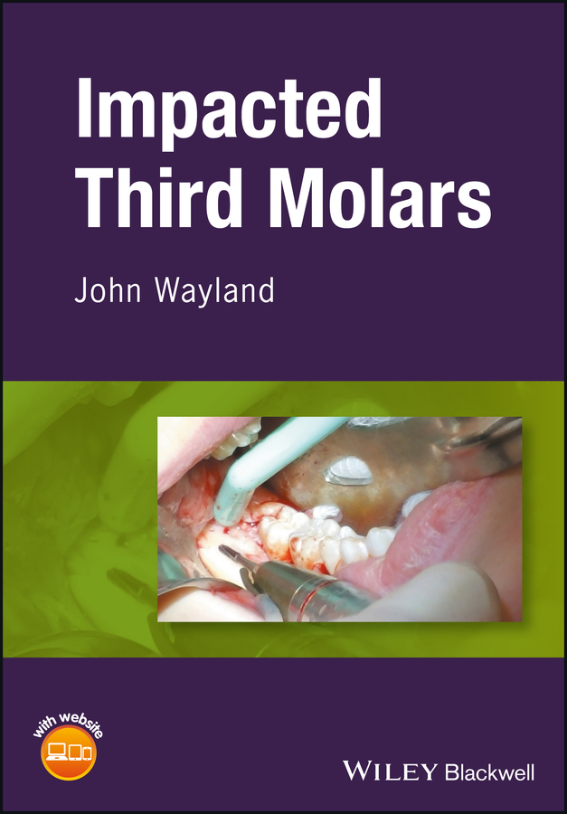 Обложка книги «Impacted Third Molars»