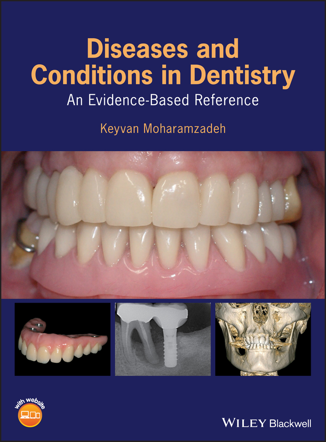 Обложка книги «Diseases and Conditions in Dentistry»