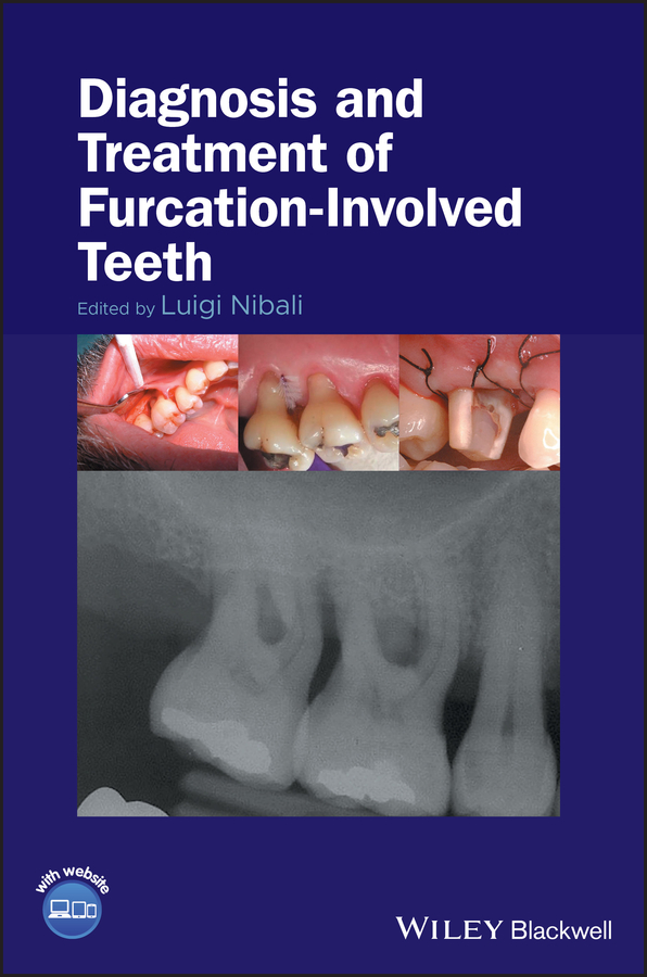 Обложка книги «Diagnosis and Treatment of Furcation-Involved Teeth»