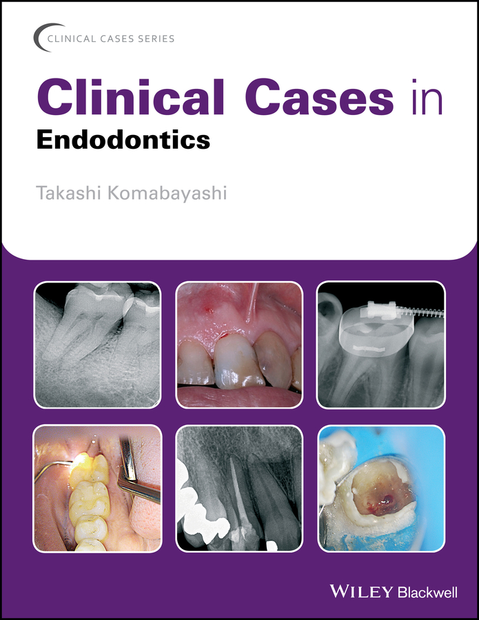 Обложка книги «Clinical Cases in Endodontics»