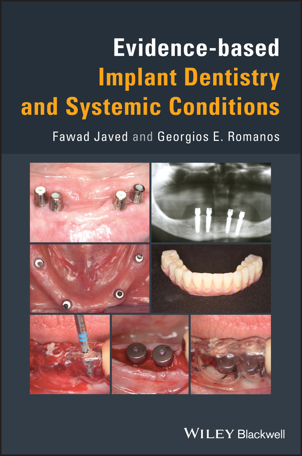 Обложка книги «Evidence-based Implant Dentistry and Systemic Conditions»