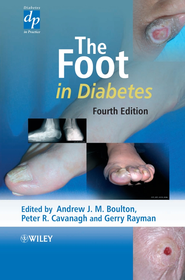 Обложка книги «The Foot in Diabetes»
