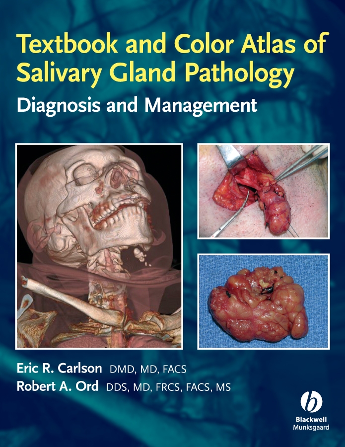Обложка книги «Textbook and Color Atlas of Salivary Gland Pathology»