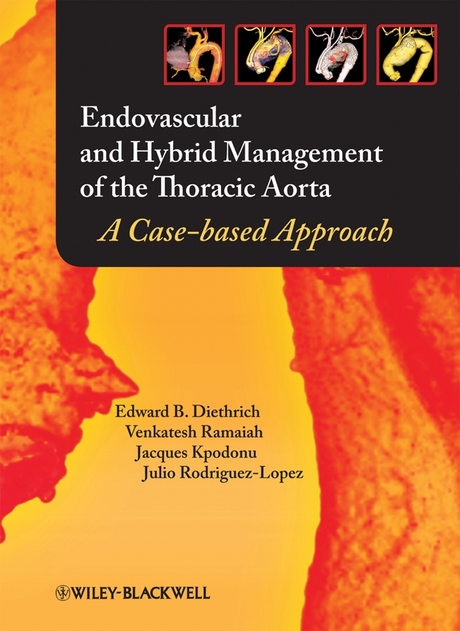 Обложка книги «Endovascular and Hybrid Management of the Thoracic Aorta»