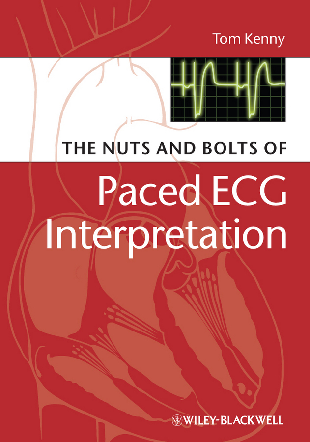 Обложка книги «The Nuts and bolts of Paced ECG Interpretation»