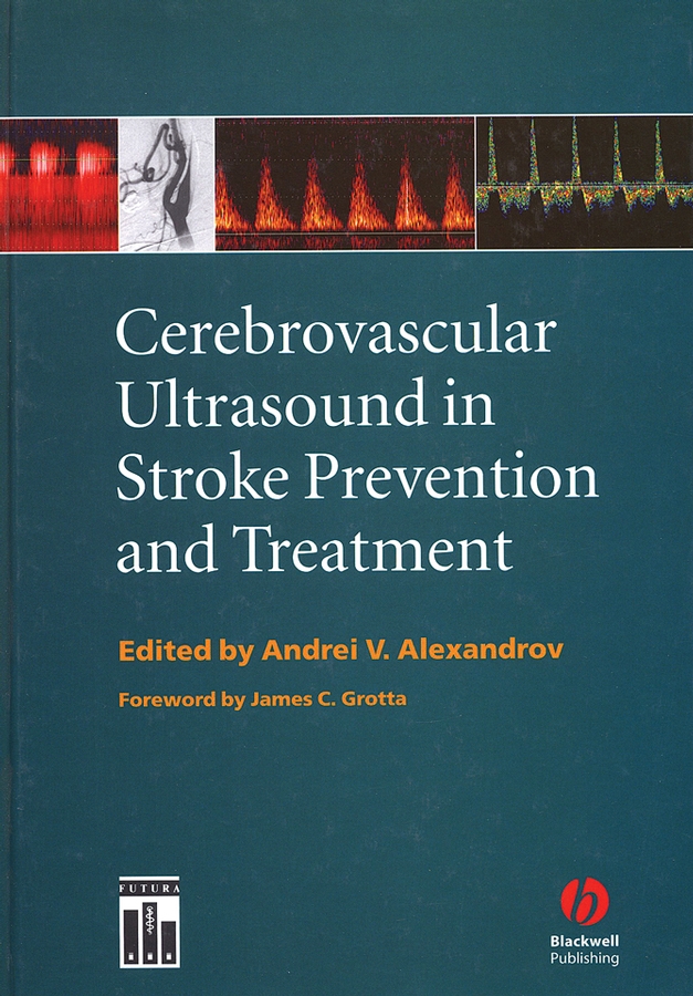 Обложка книги «Cerebrovascular Ultrasound in Stroke Prevention and Treatment»
