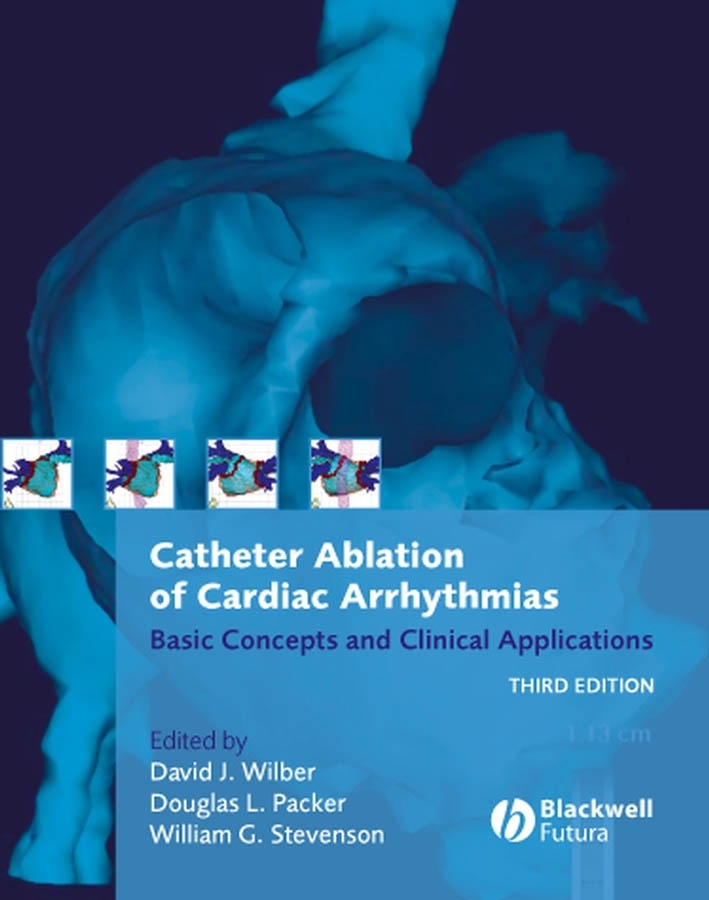 Обложка книги «Catheter Ablation of Cardiac Arrhythmias»