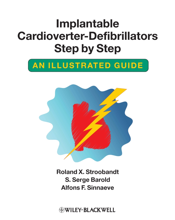 Обложка книги «Implantable Cardioverter - Defibrillators Step by Step»