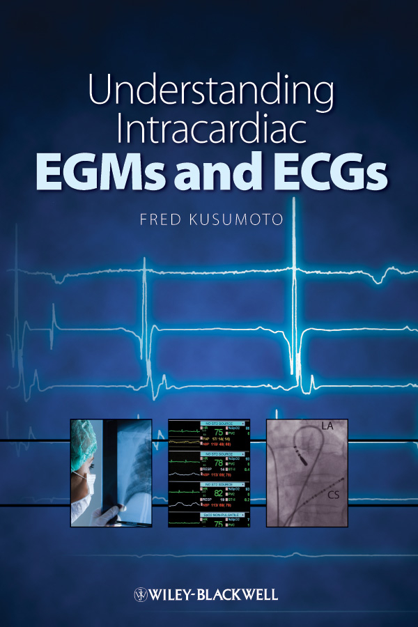 Обложка книги «Understanding Intracardiac EGMs and ECGs»