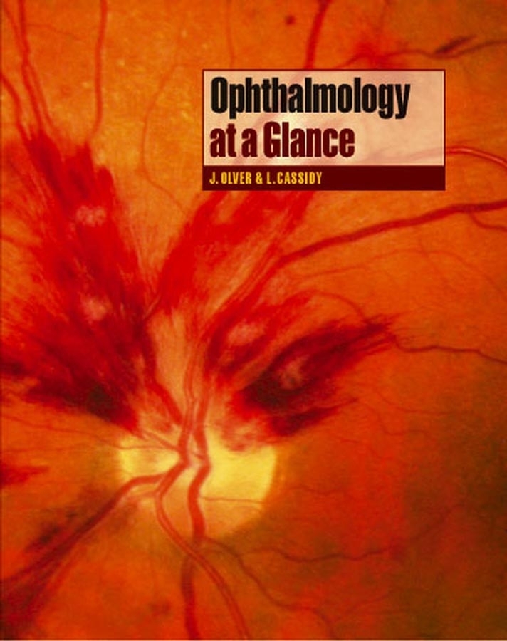 Обложка книги «Ophthalmology at a Glance»