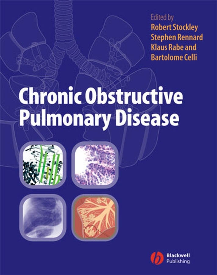 Обложка книги «Chronic Obstructive Pulmonary Disease»