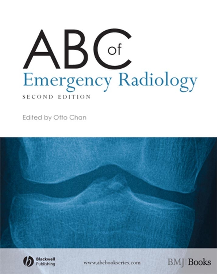 Обложка книги «ABC of Emergency Radiology»