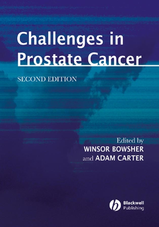 Обложка книги «Challenges in Prostate Cancer»