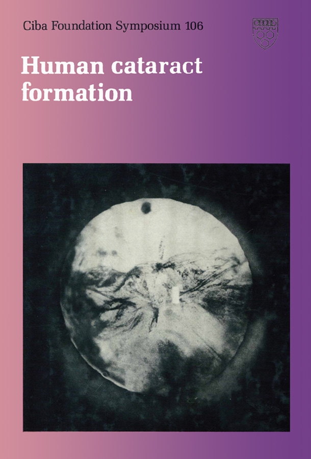 Обложка книги «Human Cataract Formation»