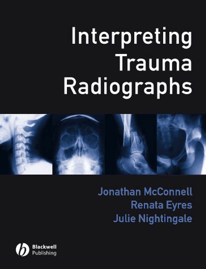 Обложка книги «Interpreting Trauma Radiographs»