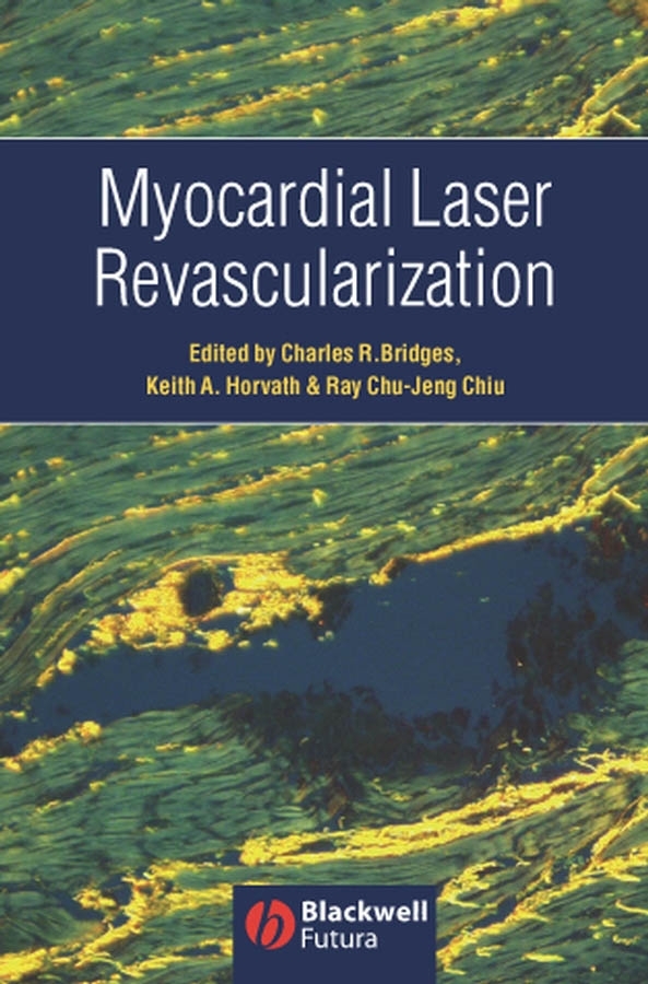 Обложка книги «Myocardial Laser Revascularization»