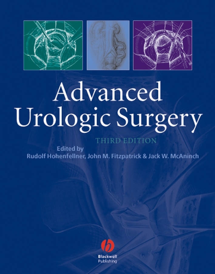 Обложка книги «Advanced Urologic Surgery»