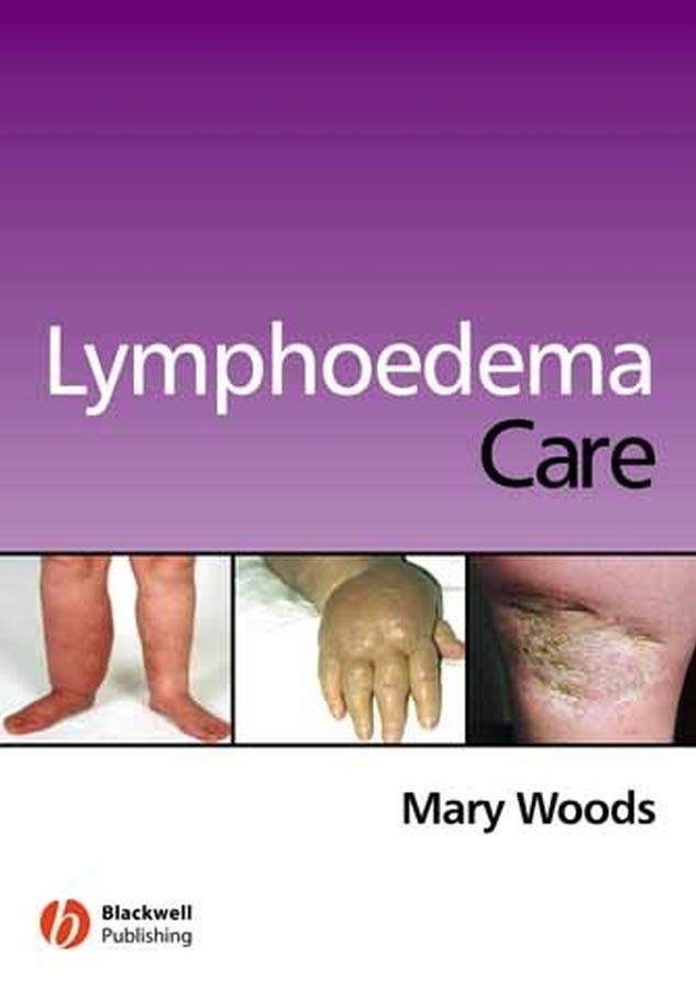 Обложка книги «Lymphoedema Care»