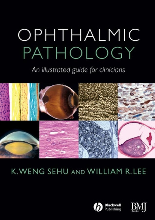 Обложка книги «Ophthalmic Pathology»
