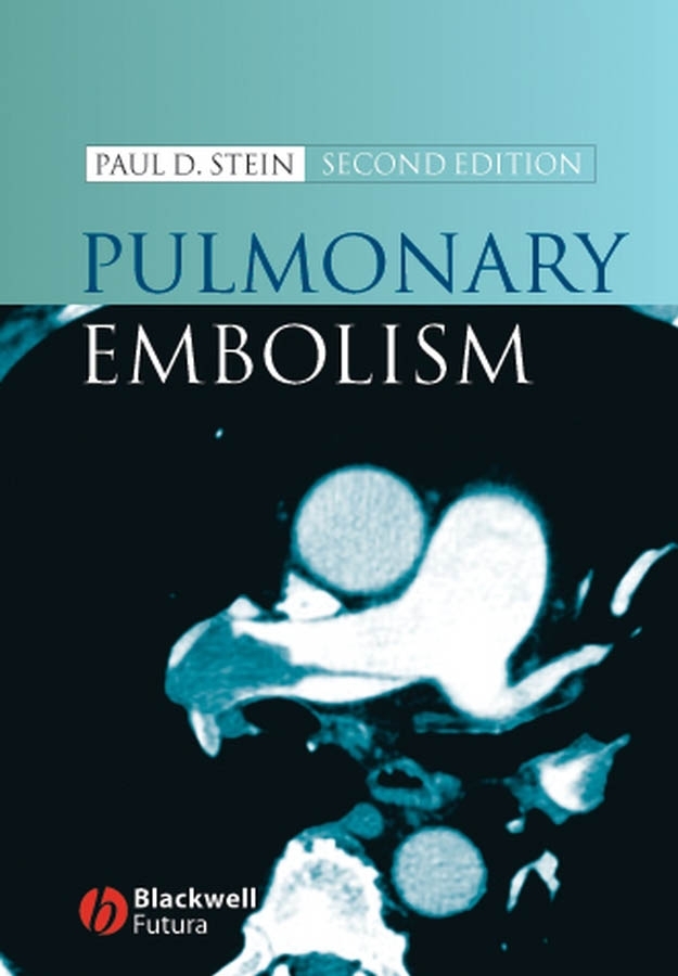 Обложка книги «Pulmonary Embolism»