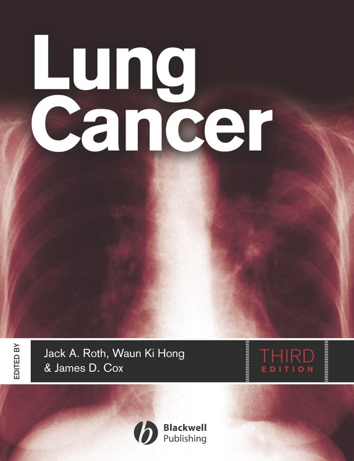 Обложка книги «Lung Cancer»