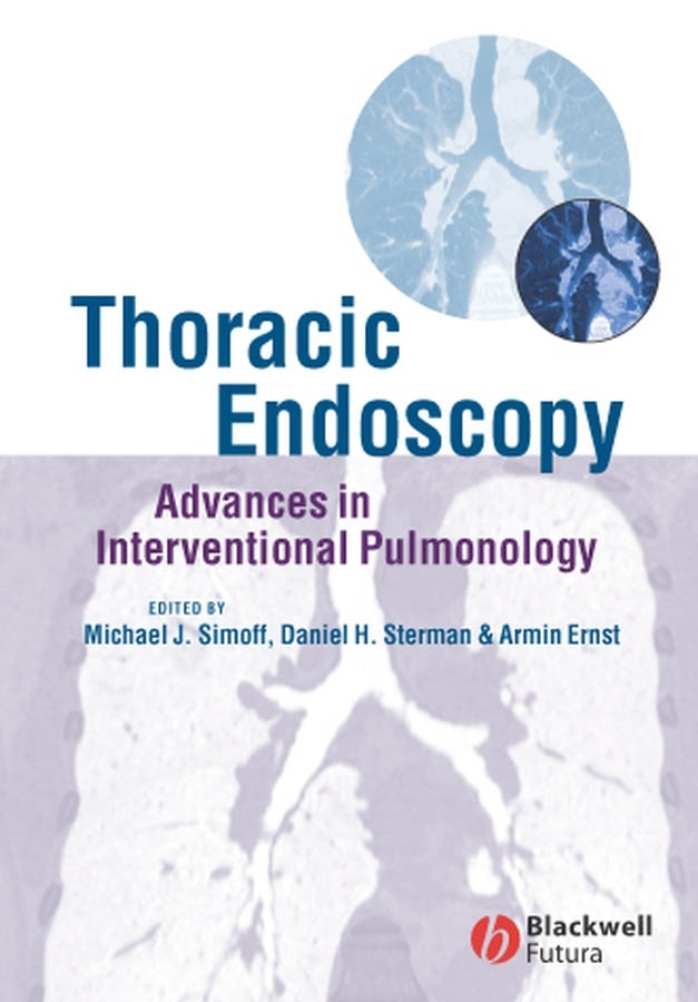 Обложка книги «Thoracic Endoscopy»
