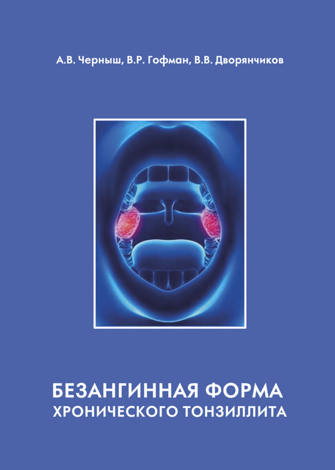 Обложка книги «Безангинная форма хронического тонзиллита»